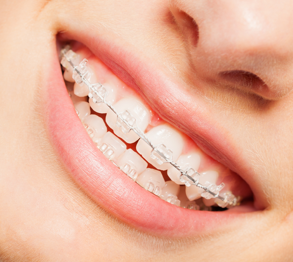Specialist Orthodontics Brentwood, Essex - Smile HQ