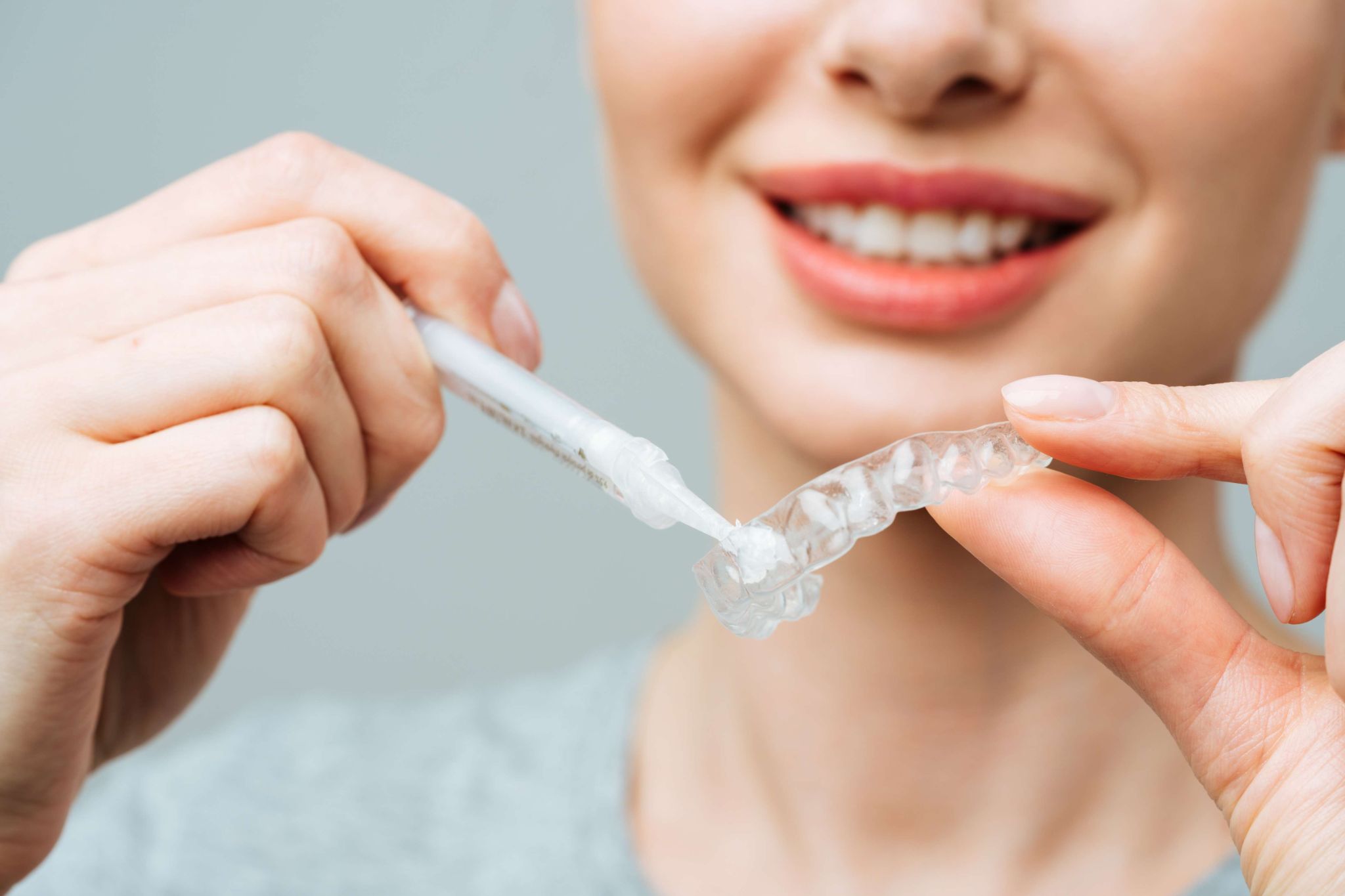 Custom dental whitening tray used in professional teeth whitening treatment at SmileHQ